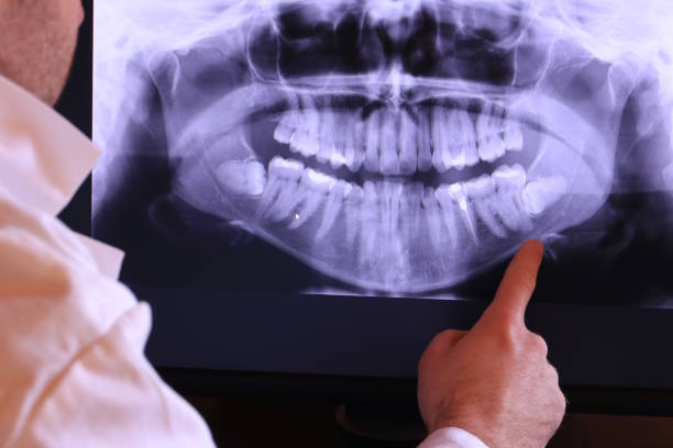 Best Emergency Treatment for Toothache in Rosenberg, TX