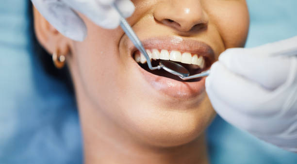 Best Emergency Treatment for Toothache in Rosenberg, TX